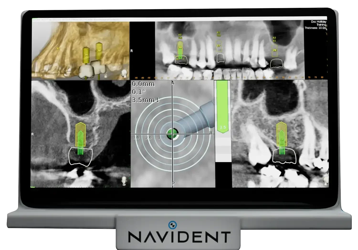 Navi_scene_2_frames-landscape-2e3ed6a9650944342fd85344f114e3d2-